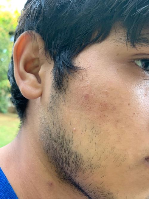 El hijo de Guevara también fue golpeado por la policía