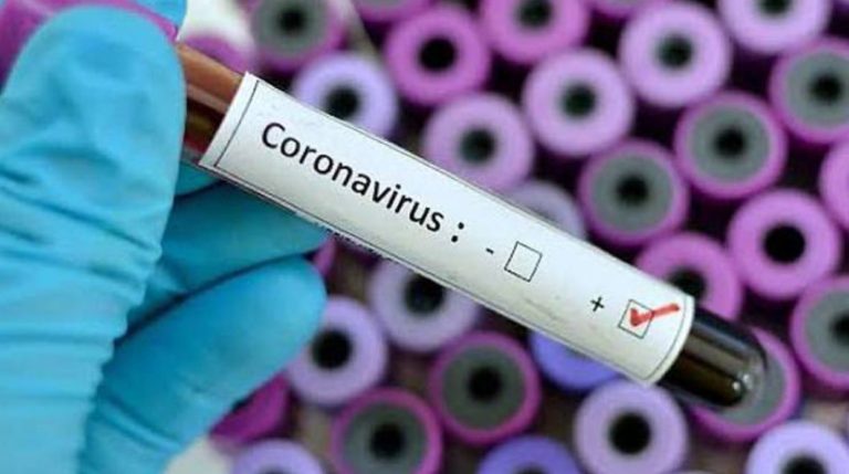 casos de covid19 suben a siete