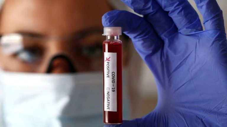 cifra por covid19 no coinciden