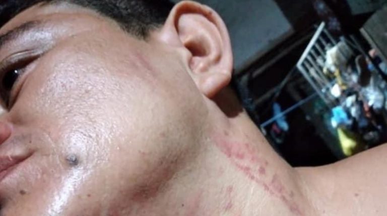 Salablanca el opositor más asediado