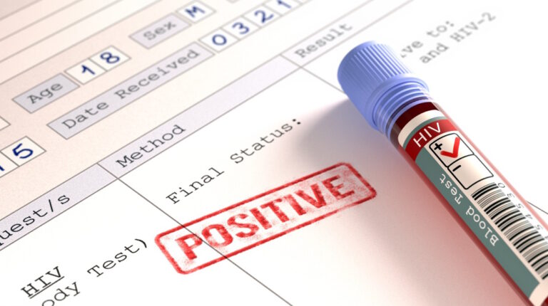 incremento casos VIH en Nicaragua