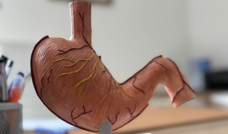 cancer-estomago-nicaragua